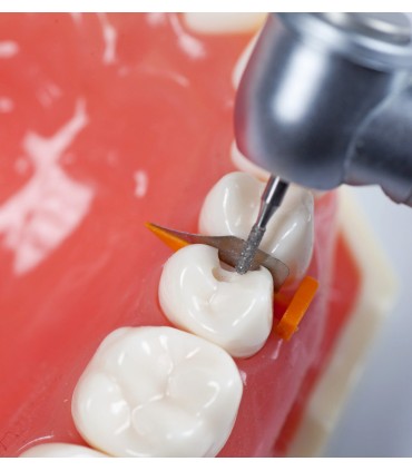 فندروج FenderWedge